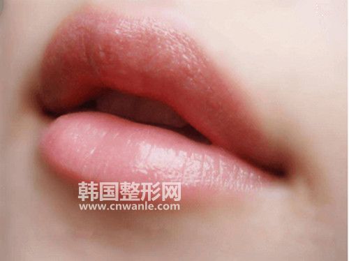 口角成型<a href='/tag_zhengxingshoushu5.html'>整形手術(shù)</a>前和術(shù)后需要注意的事項(xiàng)有哪些?