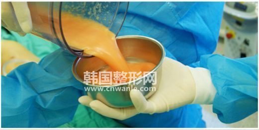 <a href='/tag_xiaotui26.html'>小腿</a><a href='/tag_xizhi74.html'>吸脂</a>術(shù)<a href='/tag_shouxiaotui8.html'>瘦小腿</a>有哪些注意事項？