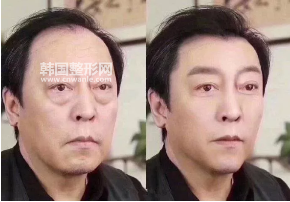 <a href='/tag_wocan4.html'>臥蠶</a>是什么？