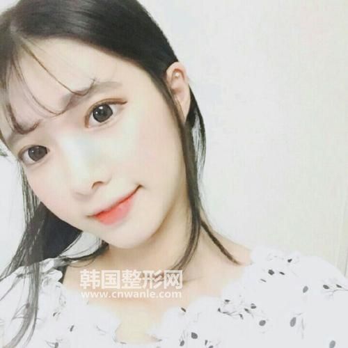 <a href='/tag_tuchun9.html'>兔唇</a>唇裂疤痕修復(fù)的方法有哪些?