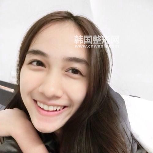 現(xiàn)在割<a href='/tag_shuangyanpidejia.html'>雙眼皮的價格</a>是多少錢?