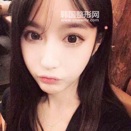 <a href='/tag_maixian35.html'>埋線</a><a href='/tag_shuangyan108.html'>雙眼</a>皮斷了怎么辦?如何修復?