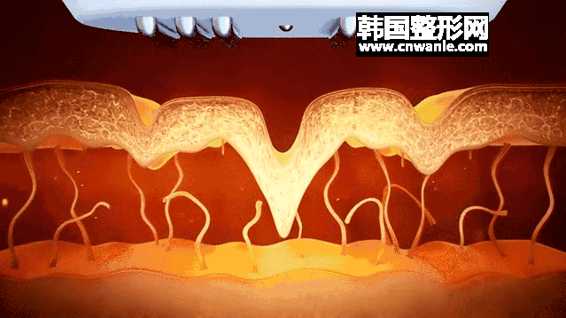 /uploads/question/20200403/a70089fbdac2aa97e1a38c2cd747be31.gif