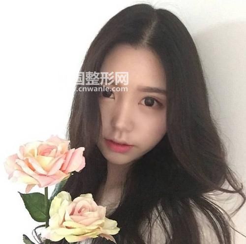 請問做埋線<a href='/tag_shuangyanpi53.html'>雙眼皮</a>以后多久可以恢復(fù)自然狀態(tài)出門？