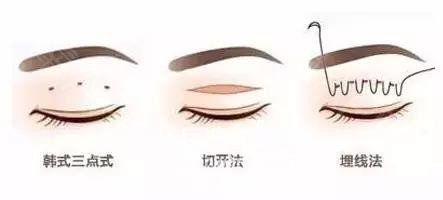 <a href='/tag_maixian35.html'>埋線</a><a href='/tag_shuangyan108.html'>雙眼</a>皮注意事項(xiàng)有哪些？