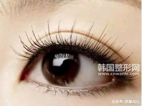 微創(chuàng)雙眼皮手術(shù)多久可以洗臉 術(shù)后如何護理
