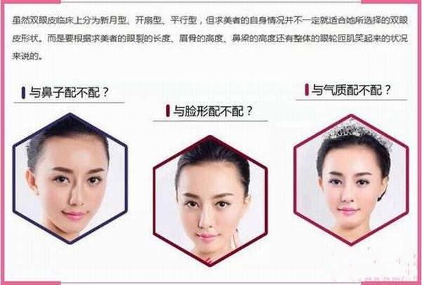 如何更根據(jù)臉型選擇適合自己的<a href='/tag_shuangyan108.html'>雙眼</a>皮術(shù)？