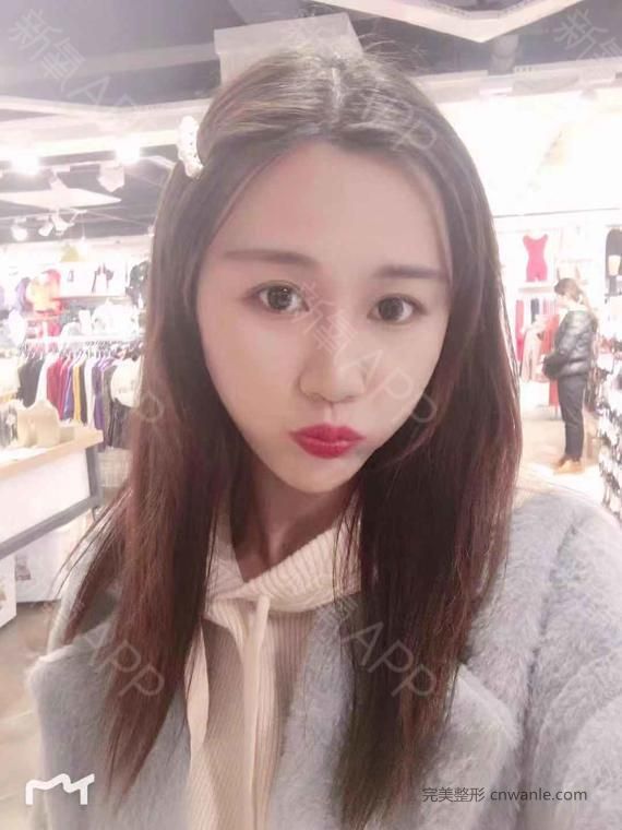 術(shù)后當(dāng)自強(qiáng)