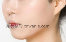 玻尿酸豐面頰會(huì)有效果嗎