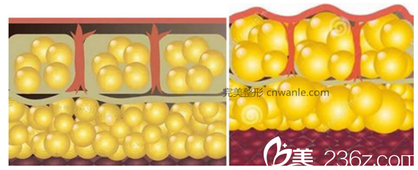 和正常脂肪細(xì)胞相比變大的細(xì)胞