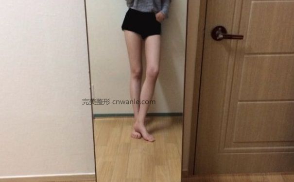 <a href='/tag_datuixizhishu.html'>大腿吸脂術(shù)</a>會(huì)反彈嗎？大腿吸脂術(shù)要注意什么？(1)