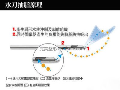 腿部吸脂會反彈嗎?