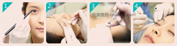 方法