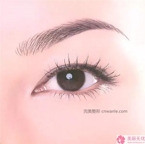 半永久紋發(fā)際線的優(yōu)缺點(diǎn)