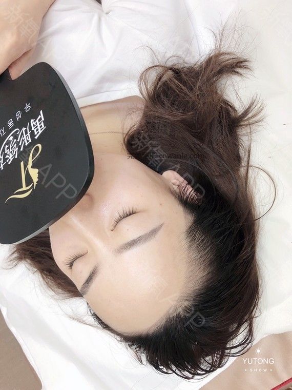 半永久紋發(fā)際線(xiàn)