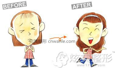 發(fā)際線后移怎么辦