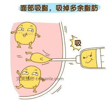 吸脂瘦臉效果怎樣