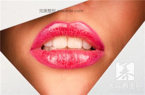 嘴角上翹整形