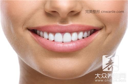 嘴角上翹整形
