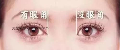 開內眼角除了讓眼睛變大還有哪些好處