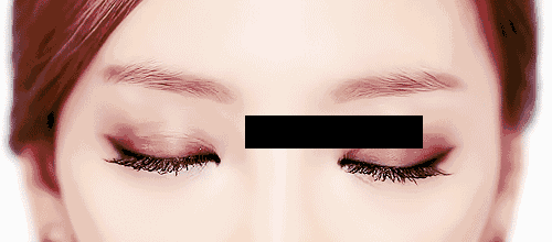 怎么判斷需不需要開眼角？