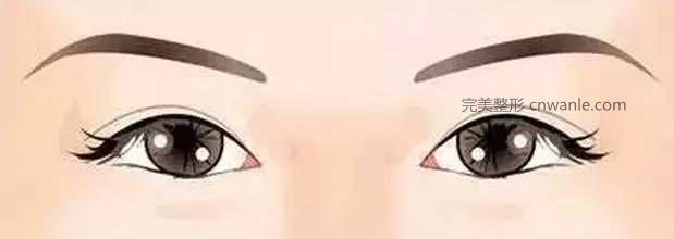 怎么判斷需不需要開眼角？