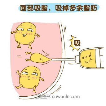 吸脂瘦臉效果怎樣