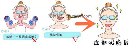 <a href='/tag_mianbuxizhishou4.html'>面部吸脂瘦臉</a>效果