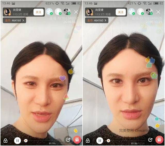 24歲超女整容殞命，江映蓉整成鬼，她整成男人，她穿裙子困難？