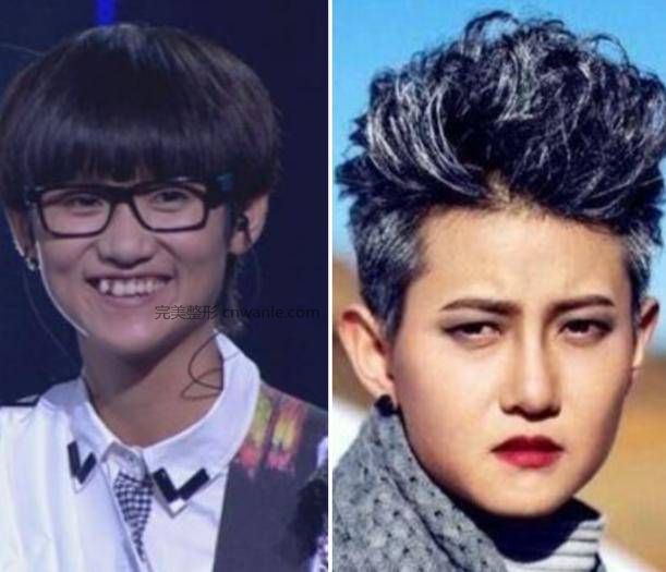 24歲超女整容殞命，江映蓉整成鬼，她整成男人，她穿裙子困難？