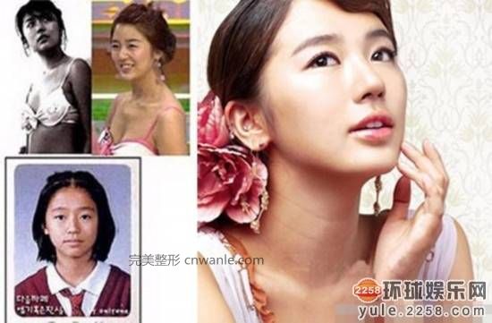 圖揭韓國明星整容部位 整容前后對比太驚悚