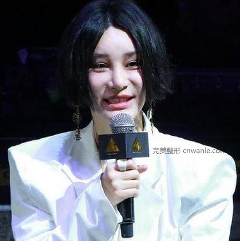 24歲超女整容殞命，江映蓉整成鬼，她整成男人，她穿裙子困難？