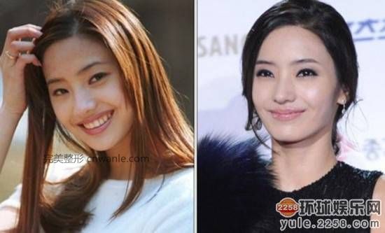 圖揭韓國明星整容部位 整容前后對比太驚悚