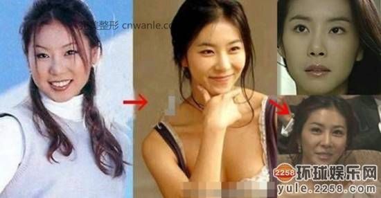 圖揭韓國明星整容部位 整容前后對比太驚悚