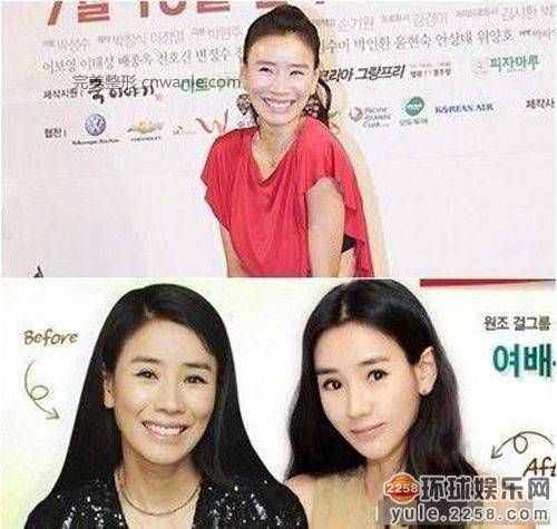 圖揭韓國明星整容部位 整容前后對比太驚悚