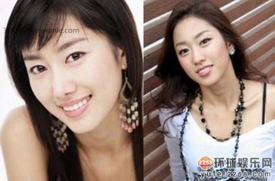 圖揭韓國明星整容部位 整容前后對比太驚悚