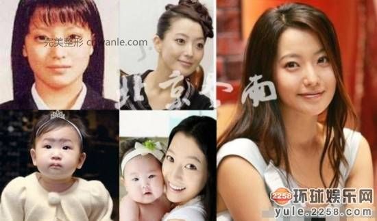 圖揭韓國明星整容部位 整容前后對比太驚悚