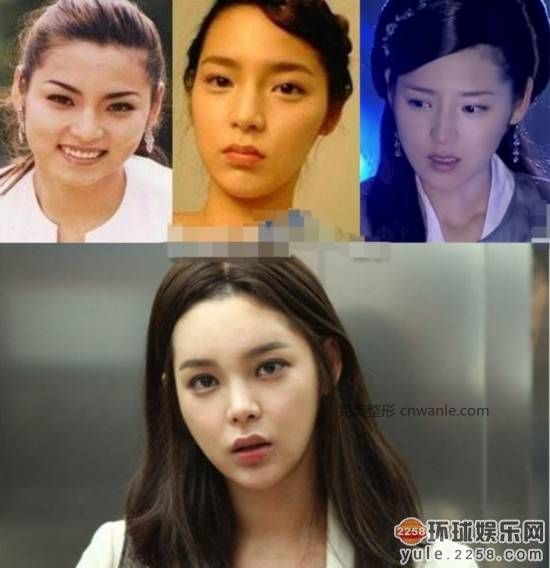 圖揭韓國明星整容部位 整容前后對比太驚悚