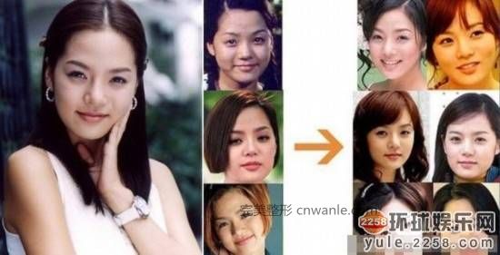 圖揭韓國明星整容部位 整容前后對比太驚悚