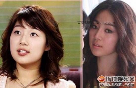 圖揭韓國明星整容部位 整容前后對比太驚悚