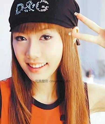 24歲超女整容殞命，江映蓉整成鬼，她整成男人，她穿裙子困難？