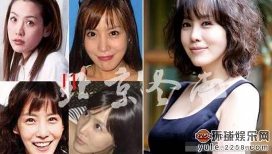圖揭韓國明星整容部位 整容前后對比太驚悚