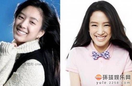 圖揭韓國明星整容部位 整容前后對比太驚悚