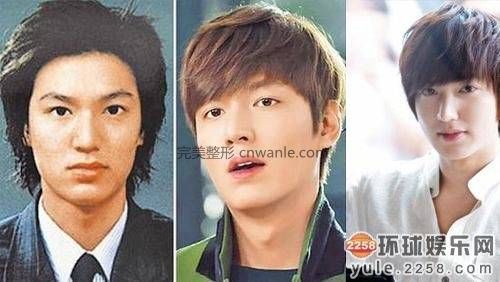 圖揭韓國明星整容部位 <a href='/tag_zhengrongqianhou2.html'>整容前后</a>對比太驚悚