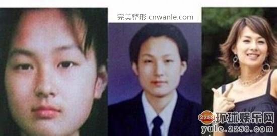 圖揭韓國明星整容部位 整容前后對比太驚悚