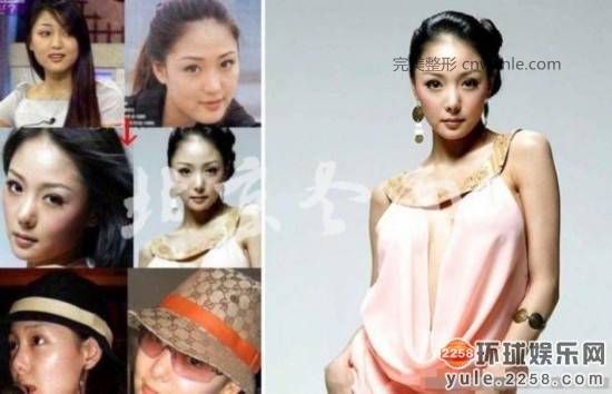 圖揭韓國明星整容部位 整容前后對比太驚悚