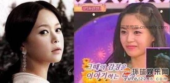 圖揭韓國明星整容部位 整容前后對比太驚悚