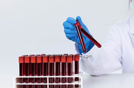  施爾美割雙眼皮跟開眼角可以同時做嗎？效果好不好？