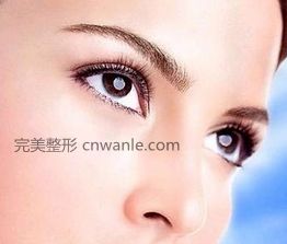 開眼角手術(shù)多久可以恢復(fù)？