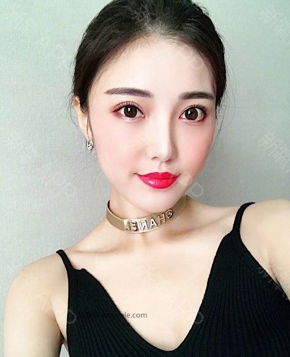 術(shù)后當(dāng)自強(qiáng)